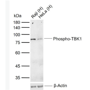 Anti-Phospho-TBK1 (Ser172) antibody-磷酸化NF-κB活化激酶抗体