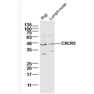 Anti-CXCR5 antibody-细胞表面趋化因子受体5（CD185）抗体