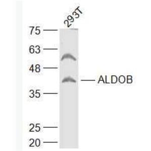 Anti-ALDOB antibody-醛缩酶2抗体