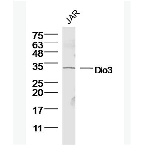 Anti-Dio3 antibody-甲状腺素5'脱碘酶3抗体