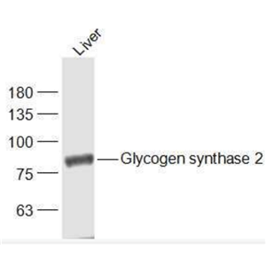 Anti-Glycogen synthase 2 antibody-葡萄糖合成酶2抗体
