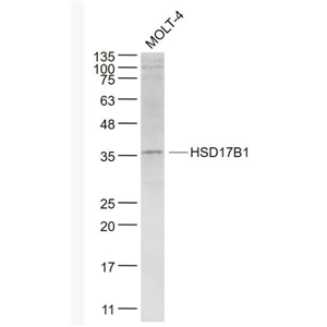 Anti-HSD17B1  antibody-羟类固醇脱氢酶17β-HSD抗体