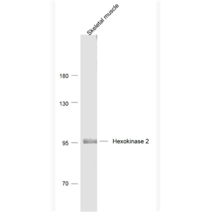 Anti-Hexokinase 2  antibody-己糖激酶2抗体