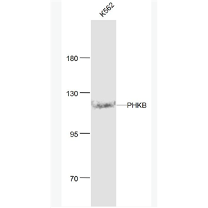 Anti-PHKB antibody-磷酸化酶β抗体