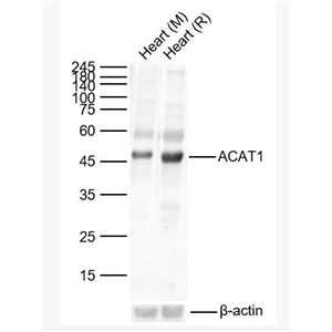 Anti-ACAT1 antibody-乙酰辅酶A酰基转移酶1抗体
