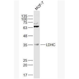 Anti-LDHC antibody-乳酸脱氢酶LDH-C/肿瘤/睾丸抗原32抗体