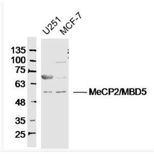 Anti-MeCP2  antibody-甲基化CpG结合蛋白2抗体,MeCP2