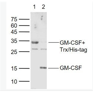Anti-GM-CSF  antibody-粒细胞-巨噬细胞克隆刺激因子抗体