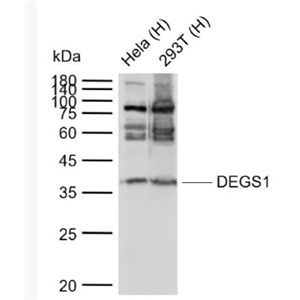 Anti-DEGS1 antibody-退行性精母细胞同源物1抗体