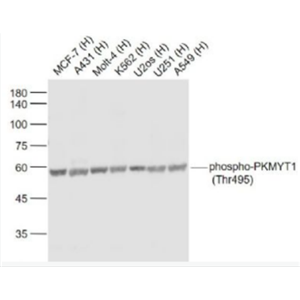 Anti-phospho-PKMYT1 (Thr495) antibody-磷酸化蛋白激酶PKMYT1(Thr495)抗体,phospho-PKMYT1 (Thr495)