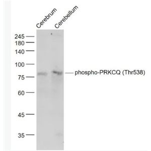 Anti-phospho-PRKCQ (Thr538) antibody-磷酸化蛋白激酶C theta抗体,phospho-PRKCQ (Thr538)