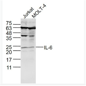 Anti-IL-6 antibody-白介素6