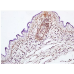 Anti-phospho-RAF1 (Ser339) antibody-磷酸化原癌基因RAF1抗體