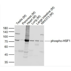 Anti-phospho-HSF1 (Ser307) antibody-磷酸化热休克因子1抗体