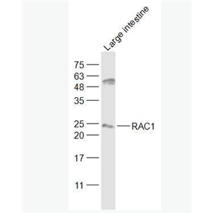 Anti-RAC1 antibody-细胞迁移诱导因子5抗体