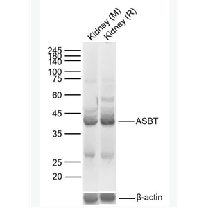 Anti-SLC10A2 antibody-顶膜钠依赖性胆盐转运体蛋白抗体