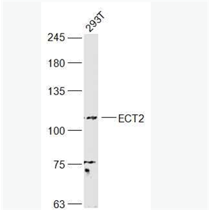 Anti-ECT2 antibody-上皮细胞癌转化蛋白2抗体