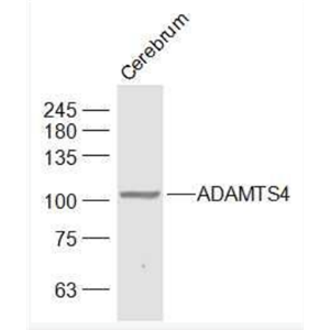 Anti-ADAMTS4 antibody-ADAMTS4抗體,ADAMTS4