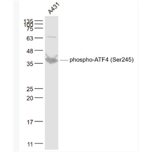 Anti-phospho-ATF4 (Ser245) antibody-磷酸化活化转录因子4抗体