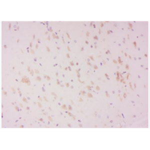 Anti-phospho-LATS2 (Ser83) antibody-磷酸化腫瘤抑制基因LATS2抗體