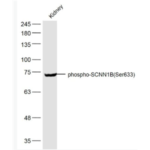 Anti-phospho-SCNN1B (Ser633) antibody-磷酸化上皮钠通β抗体,phospho-SCNN1B (Ser633)