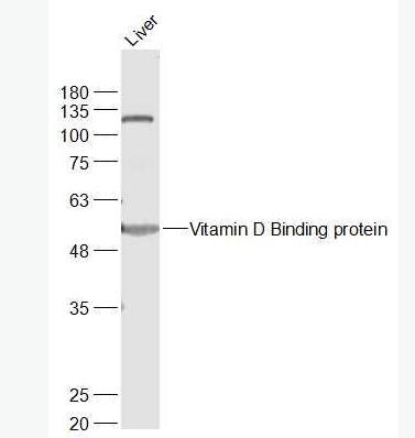 Anti-Vitamin D Binding protein antibody-维生素D结合蛋白抗体,Vitamin D Binding protein