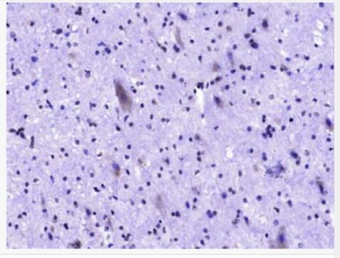 Anti-Phospho-c-Kit (Tyr721) antibody-磷酸化原癌基因蛋白c-kit（CD117）抗體,Phospho-c-Kit (Tyr721)