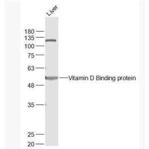 Anti-Vitamin D Binding protein antibody-维生素D结合蛋白抗体,Vitamin D Binding protein