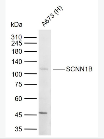 Anti-SCNN1B antibody-上皮钠通道β抗体,SCNN1B