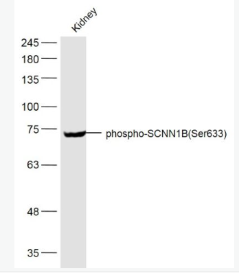 Anti-phospho-SCNN1B (Ser633) antibody-磷酸化上皮钠通β抗体,phospho-SCNN1B (Ser633)