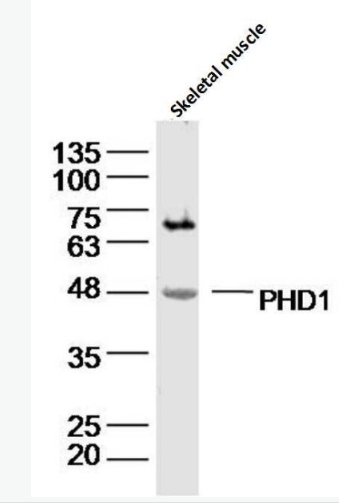 Anti-PHD1 antibody-脯氨酰羟化酶抗体,PHD1