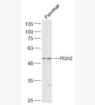 Anti-PDIA2  antibody-蛋白质二硫键异构酶抗体,PDIA2