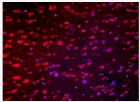 Anti-Robo antibody-轴突导向受体抗体,Robo