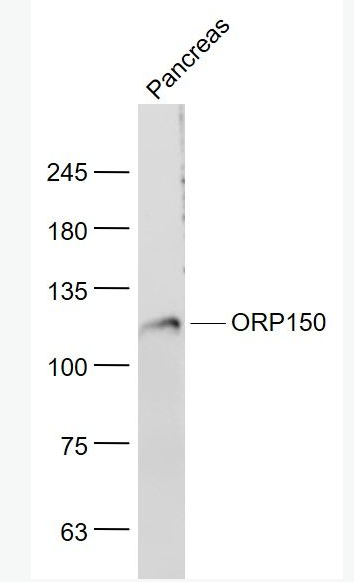 Anti-ORP150 antibody-氧气调节蛋白150抗体,ORP150