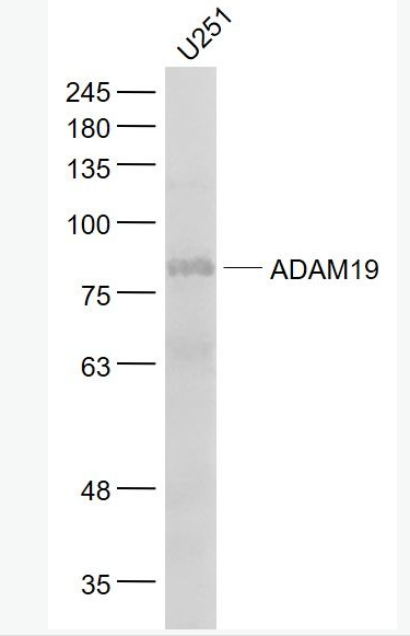Anti-ADAM19 antibody-去整合素样金属蛋白酶19抗体,ADAM19