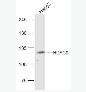 Anti-HDAC9 antibody-组蛋白去乙酰化酶9抗体,HDAC9