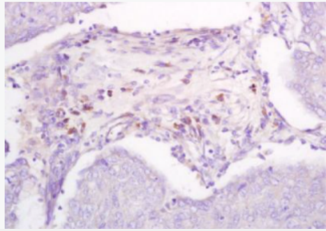 Anti-DBC2 antibody-乳腺癌基因删除蛋白2抗体,DBC2