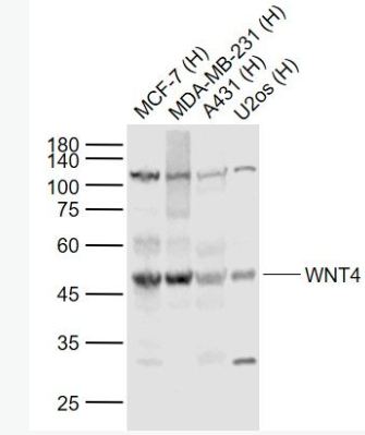 Anti-WNT4 antibody-信號通路Wnt4抗體,WNT4