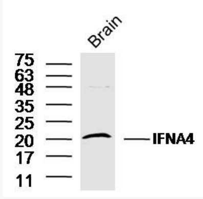 Anti-IFNA4 antibody-干擾素α4抗體,IFNA4