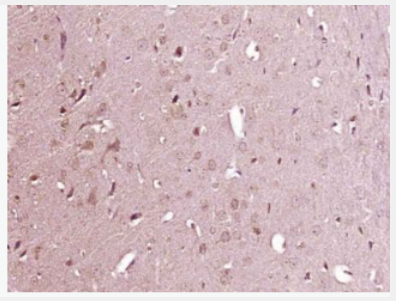 Anti-CXCL13/BCA1 antibody-B-淋巴细胞趋化因子抗体,CXCL13/BCA1