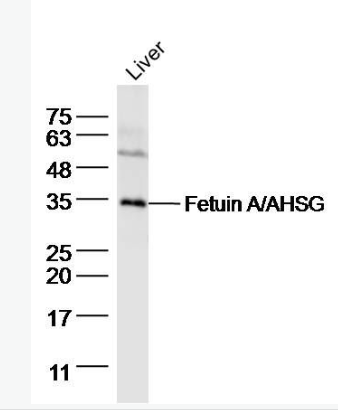 Anti-Fetuin A/AHSG antibody-胎球蛋白A,Fetuin A/AHSG