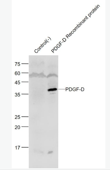 Anti-PDGF-D/SCDGFB antibody-血小板源性生长因子D/脊髓源性生长因子B抗体,PDGF-D/SCDGFB