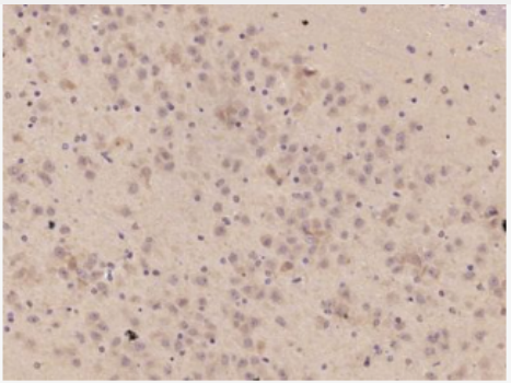 Anti-TNFAIP5 antibody-肿瘤坏死因子α诱导蛋白5抗体,TNFAIP5