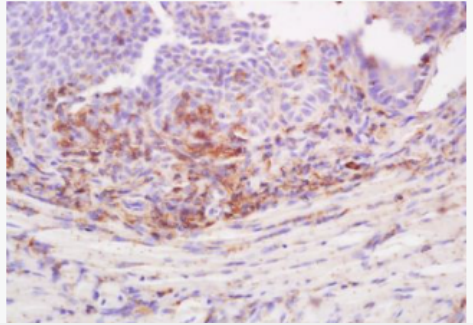 Anti-Desmoglein 3 antibody-桥粒芯蛋白3抗体,Desmoglein 3