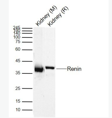 Anti-Renin antibody-肾素/血管紧张素形成酶Ren1抗体,Renin