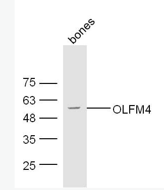 Anti-OLFM4 antibody-抗细胞凋亡蛋白OLFM44抗体,OLFM4