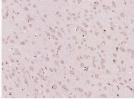 Anti-CIKS/TRAF3IP2 antibody-核因子NFκB激活蛋白1抗體,CIKS/TRAF3IP2