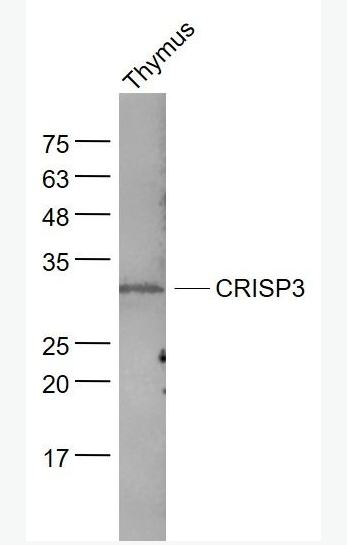Anti-CRISP3 antibody-富含半胱氨酸分泌蛋白3抗体,CRISP3
