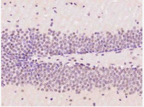 Anti-OTUB2 antibody-泛素特異性蛋白酶Otubain2抗體,OTUB2