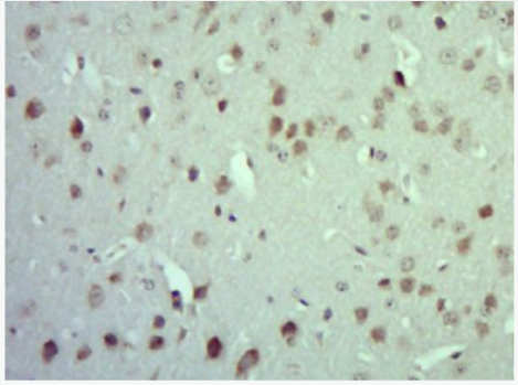 Anti-MARK4 antibody-丝氨酸/苏氨酸蛋白激酶MARK4抗体,MARK4